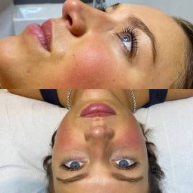 Beauty therapies at The Bellissima Clinic in Clapham, London.